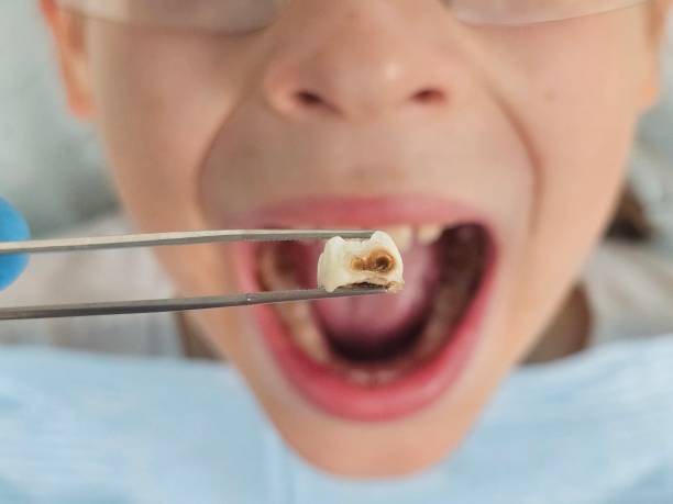 Best Weekend Emergency Dentist in Three Oaks, FL
